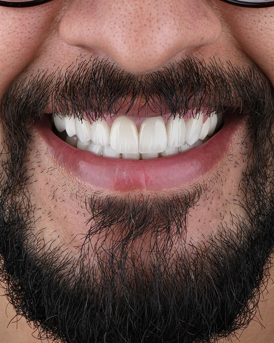 الحالة الأولى بعد العلاج